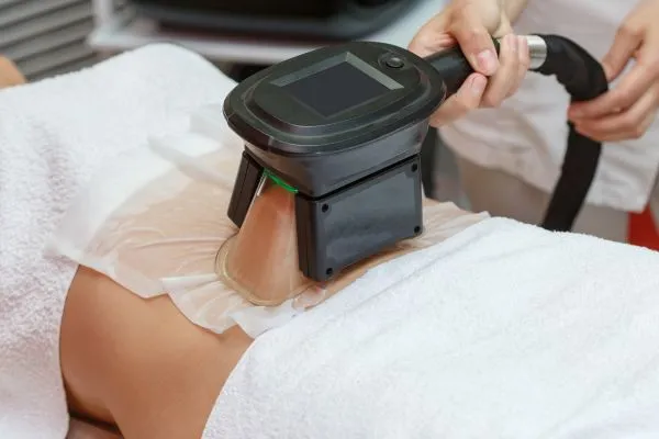Image of person having fat freezing treatment to help weight gain Avonmouth